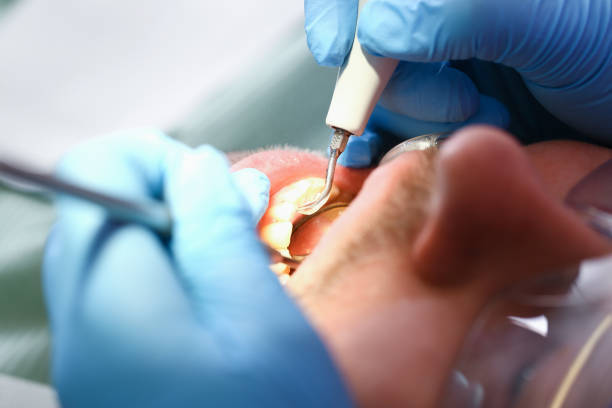 Best Emergency Dental Extractions in Rancho Alegre, TX